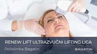 Renew Lift ultrazvučni lifting lica  Poliklinika Bagatin [upl. by Ann]