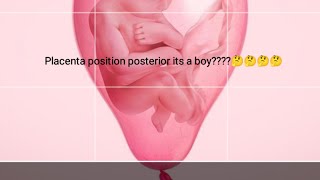 Placenta posterior है तो its a baby boy or not🤔🤔😊 [upl. by Huesman]