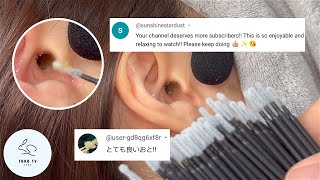 ASMR  ミクロスワブで最高の耳かき体験  Best Ear Cleaning Experience With Micro Swabs [upl. by Valora]