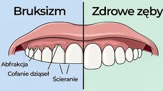 7 rzeczy których MUSISZ PRZESTRZEGAĆ aby przestać ZGRZYTAĆ ZĘBAMI [upl. by Zaria]