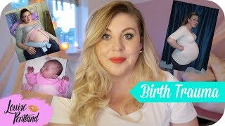 PTSD After Childbirth  Birth Trauma  MOTHERHOOD [upl. by Arymahs]