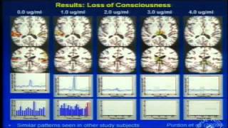 A Look at the Unconscious Brain Under General Anesthesia [upl. by Adgam]