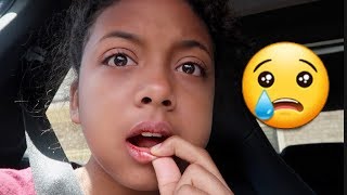 I Got My Wisdom Teeth Removed Hilarious Surgery Vlog  LexiVee03 [upl. by Prue]