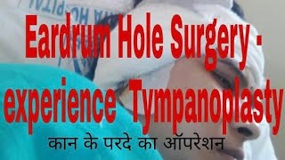 Eardrum Hole Surgery experience ear operation Tympanoplasty factsandmeinhindi [upl. by Herzberg]