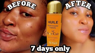 LIGHTEN YOUR SKIN safely✅HUILE Ecclaircissante TraitantestyleClair Lightening antiaging oil Review [upl. by Coffee145]