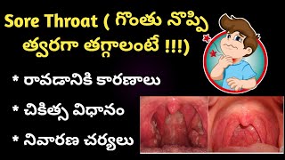 Sore Throat in Telugu గొంతు నొప్పి [upl. by Nisbet604]