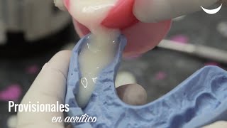 Dientes temporales o provisionales [upl. by Aserej]