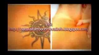 HOT TIPS How To Remove a Tattoo at Home  Before and After Natural Tattoo Removal [upl. by Medea]