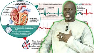 Arythmie Causes Symptômes et Conséquences  Pr Ousmane Ndiaye  SAMA XALAAT TV [upl. by Labana874]