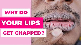 7 Causes Of Chapped Lips Know to prevent [upl. by Nnylatsyrk650]