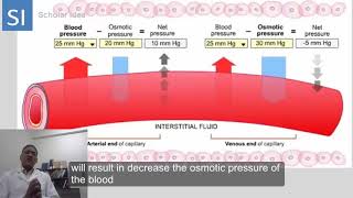 Hydrostatic pressure Vs Oncotic pressure  made easy [upl. by Rhynd]