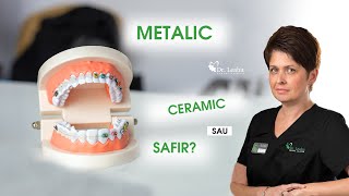 Metalic ceramic sau safir Ce aparat dentar fix este mai bun  Clinicile Dentare Dr Leahu [upl. by Gow]