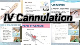 IV Cannulation Procedure GNM Fundamental Guide for Nurses [upl. by Reivaj]