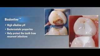 Biodentine Dentrek Module [upl. by Suciram]