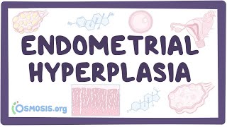 Endometrial hyperplasia  an Osmosis Preview [upl. by Dearr]