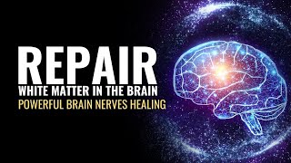 Repair White Matter In The Brain  Cognition Enhancer  Powerful Brain Nerves Healing Sound Therapy [upl. by Eeliah]