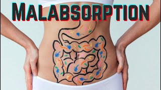 Malabsorption  CRASH Medical Review Series [upl. by Killigrew]