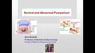 Normal and Abnormal Puerperium [upl. by Airam360]