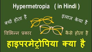 Hypermetropia causes types and treatment in Hindihypermetropia hyperopia longsightedness [upl. by Ecilahc519]