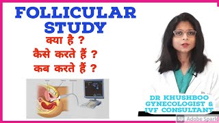 Follicular Study क्या होती है Hindi  Dr Khushboo  Mannat IVF Patna [upl. by Peatroy]