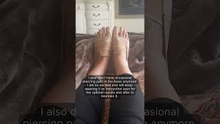 This help me straighten my bunion without surgery bunionpain shorts fyp [upl. by Alemac163]