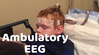 24 Hour EEG what to expect  seizures [upl. by Milinda]