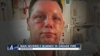 Deep fryer grease fire nearly kills father of three [upl. by Alyahc]