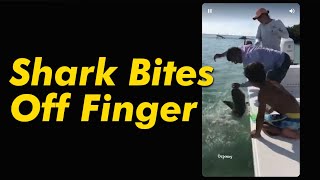 Shark Bites Off Finger [upl. by Sirc]