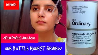 How to use Niacinamide 10  zinc1 serum hindi  Ordinary niacinamide serum 30 days honest review [upl. by Odnarb122]