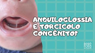 Existe relação entre anquiloglossia e torcicolo congênito RESPONDENDO PERGUNTAS [upl. by Sim]