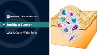 Inside a Tumor What is Cancer Video Series [upl. by Jessy209]