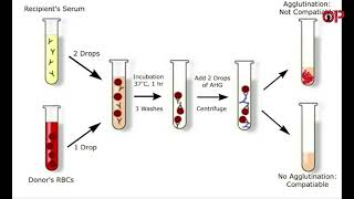 What is Cross matching its Types  procedure and interpretation [upl. by Eizle]