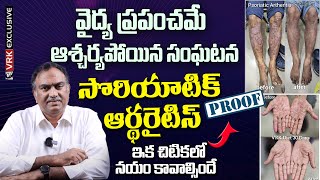 Achieve Fast Results  Psoriatic Arthritis Treatment in VRK Diet  Veeramachaneni  Telugu Health [upl. by Orji]