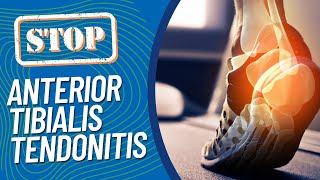 The Research on Why You Have Tibialis Anterior Tendonitis amp ScientificBacked Ways to Get Better Now [upl. by Charissa]