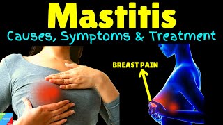 Mastitis  Breast Infection  Symptoms Causes Treatment Prevention [upl. by Aciram]