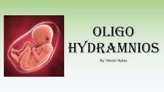 OampG Oligohydramnios  causes investigations management complications [upl. by Atilek349]