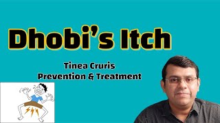 Dhobis Itch  Tinea Cruris  Prevention amp Treatment [upl. by Bergmann663]