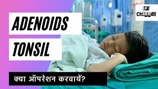 Tonsils amp Adenoids का क्या काम है और क्या इनका ऑपरेशन करवाना चाहिए [upl. by Ardnoek]