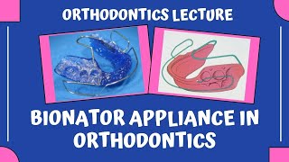 Bionator Appliance In Orthodontics  Dr Manase [upl. by Ani]