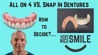 All on 4 or Snap in dentures Some points to consider [upl. by Eolanda918]