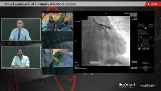 Microcirculation Clinical Cases with RayFlow by Hexacath 2021 [upl. by Trevlac445]