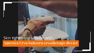 Quick upper arm skin tightening and fat burning with America Cryo localized cryotherapy [upl. by Oakleil310]