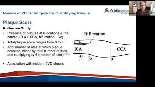 Carotid Arterial Plaque by Ultrasound  Characterization of Atherosclerosis amp Evaluation of CV Risk [upl. by Deina803]