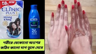 নারকেল তেল ও শ্যাম্পু মিশিয়ে এভাবে লাগান একদিনে হাতপা ধবধবে ফর্সা উজ্জ্বল হবে  coconut oil facial [upl. by Siraf]