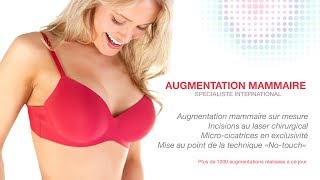 Augmentation mammaire par le Dr SMARRITO [upl. by Nuahsak]