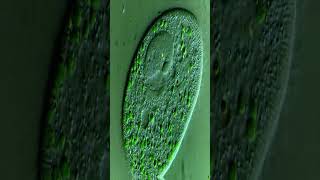 Cyanobacteria  bacterial surface  Blue green algae bloom  Chemiclean  Chemiclean cyanobacteria [upl. by Ablem952]