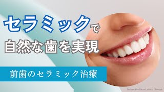 【前歯のセラミック治療】セラミック治療のカンセリングの様子をご紹介いたします！セラミック治療 セラミック歯医者 [upl. by Earised102]