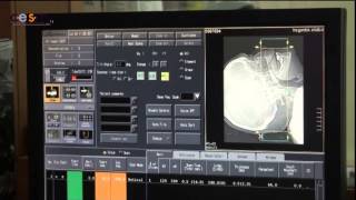 Curso de TAC Tomografía Axial Computerizada [upl. by Siekram]