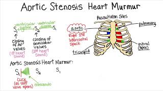 Aortic Stenosis  Part 2 Heart Murmur Series [upl. by Bartram100]