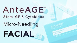 AnteAGE Microneedling Facial with LED for AntiAging [upl. by Toback]